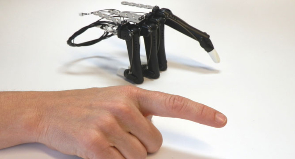 Vincent Systems entwickelt komplexe Handprothesen.