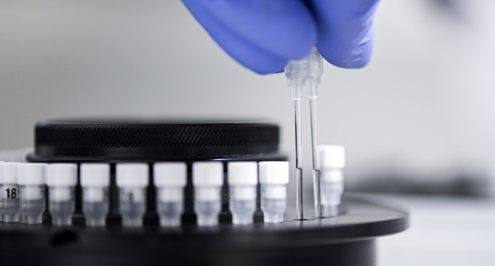 Ein Labor-Mitarbeiter bereitet Probenröhrchen zur Virus-Diagnostik (PCR, Polymerase Kettenreaktion) vor.