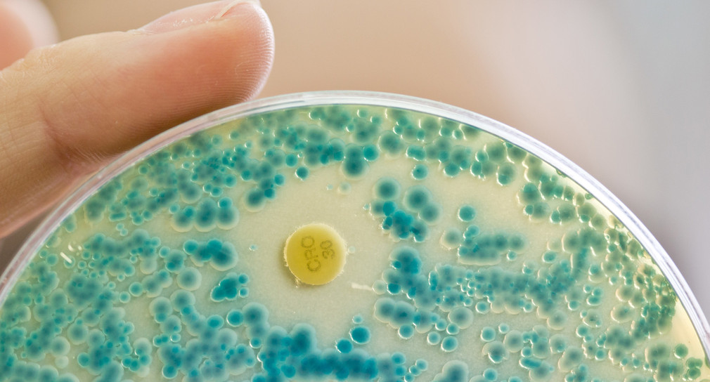 Eine Labormitarbeiterin an einem Institut für Klinische Immunologie und Hygiene hält im Diagnostiklabor eine Indikatorkulturplatte zum Nachweis von resistenten Bakterien in der Hand. (Bild: © dpa)